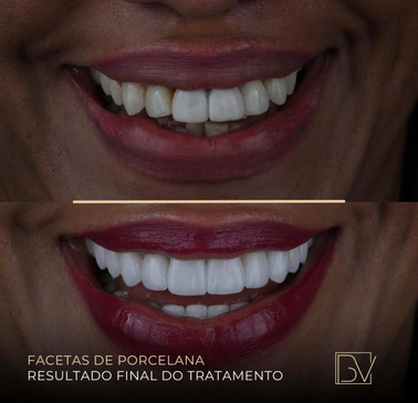 Slider image (5) Clinic Bel Viso